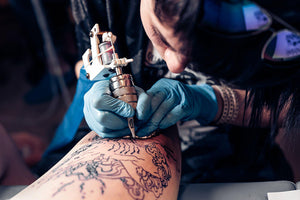How do tattoo laser removal work?